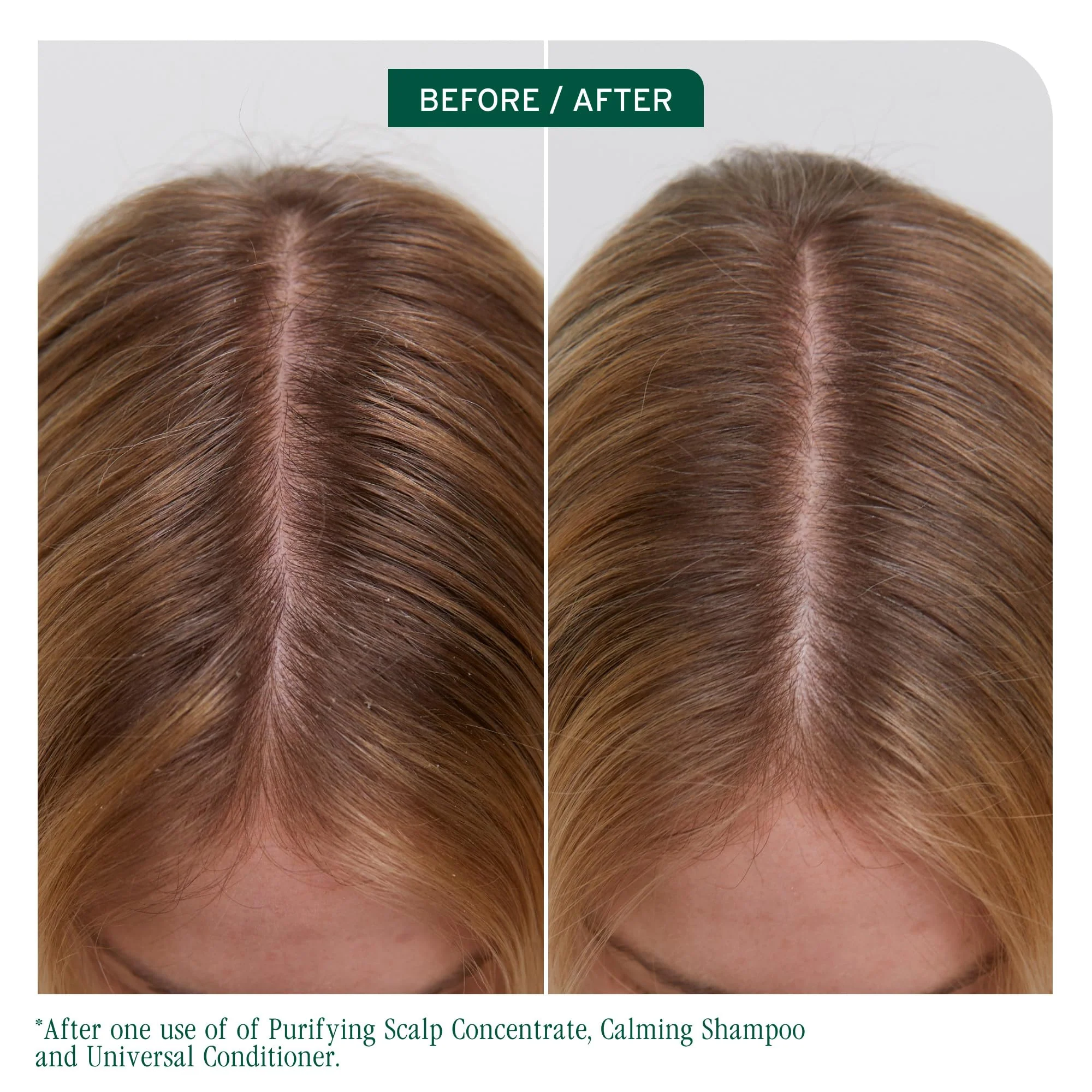 Biolage Scalp Sync Calming Shampoo - Gently Cleanses Dry & Sensitive Scalps, Hydrates & Soothes, Fermented Tea Blend & Glycolic Acid, Vegan & Paraben-Free - Image 2