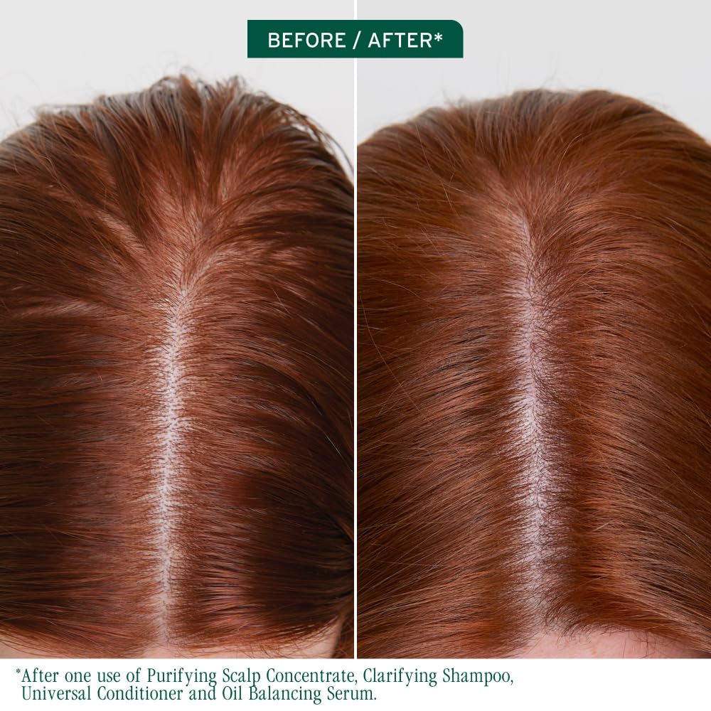 Biolage Scalp Sync Oil Balancing Hair Serum - Absorbs Excess Oil Between Washes, Leave-In Scalp Treatment, Fermented Tea Blend, Vegan, 1.6 Fl Oz - Image 2
