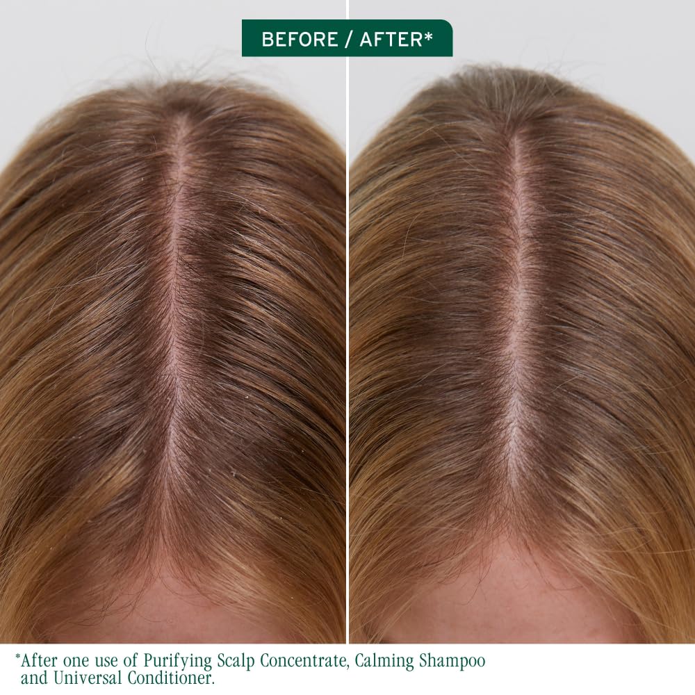 Biolage Scalp Sync Purifying Concentrate - Exfoliating & Clarifying Dry Scalp Treatment, Refreshing & Reinvigorating, Fermented Tea Blend & Glycolic Acid - Image 2