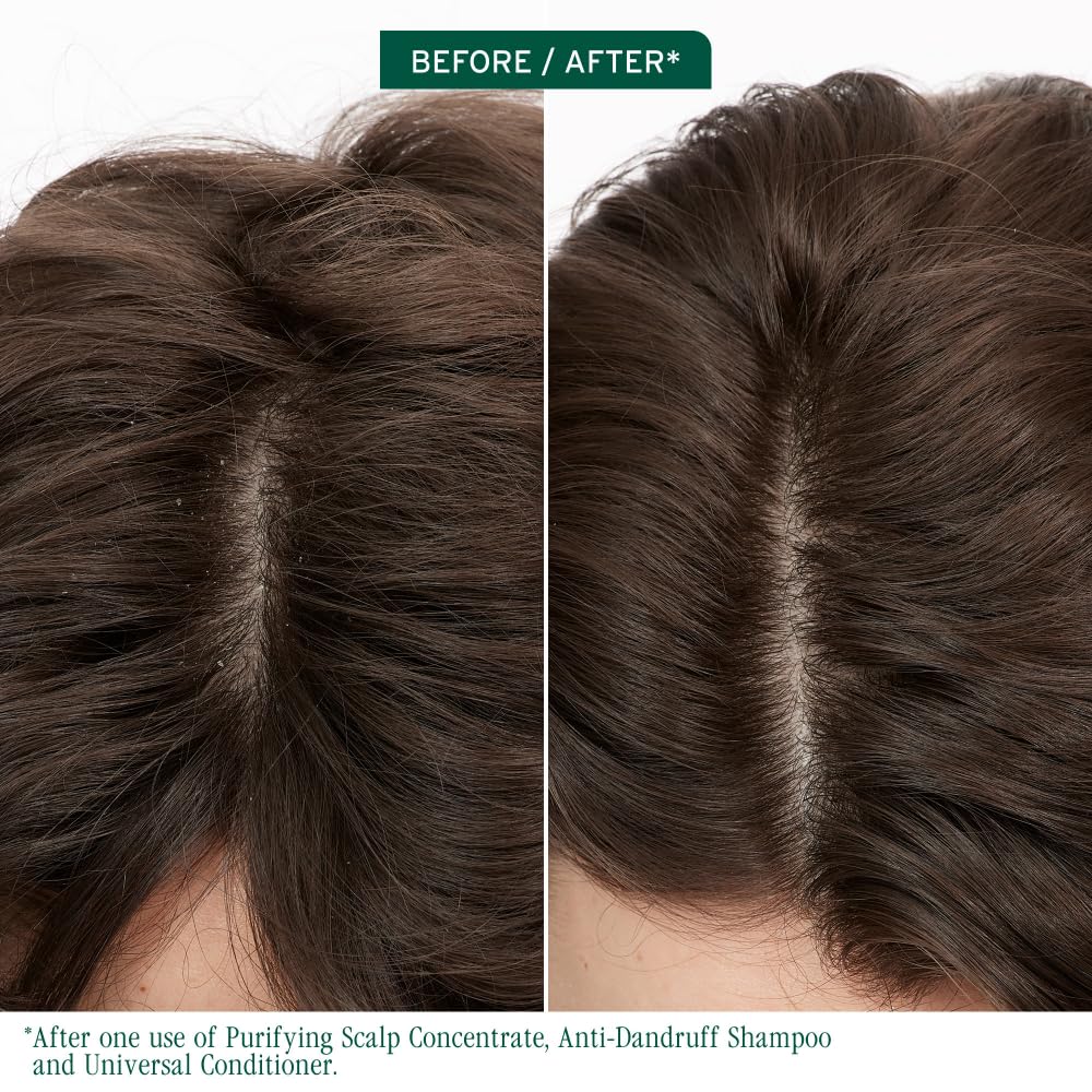 Biolage Scalp Sync Purifying Concentrate - Exfoliating & Clarifying Dry Scalp Treatment, Refreshing & Reinvigorating, Fermented Tea Blend & Glycolic Acid - Image 3