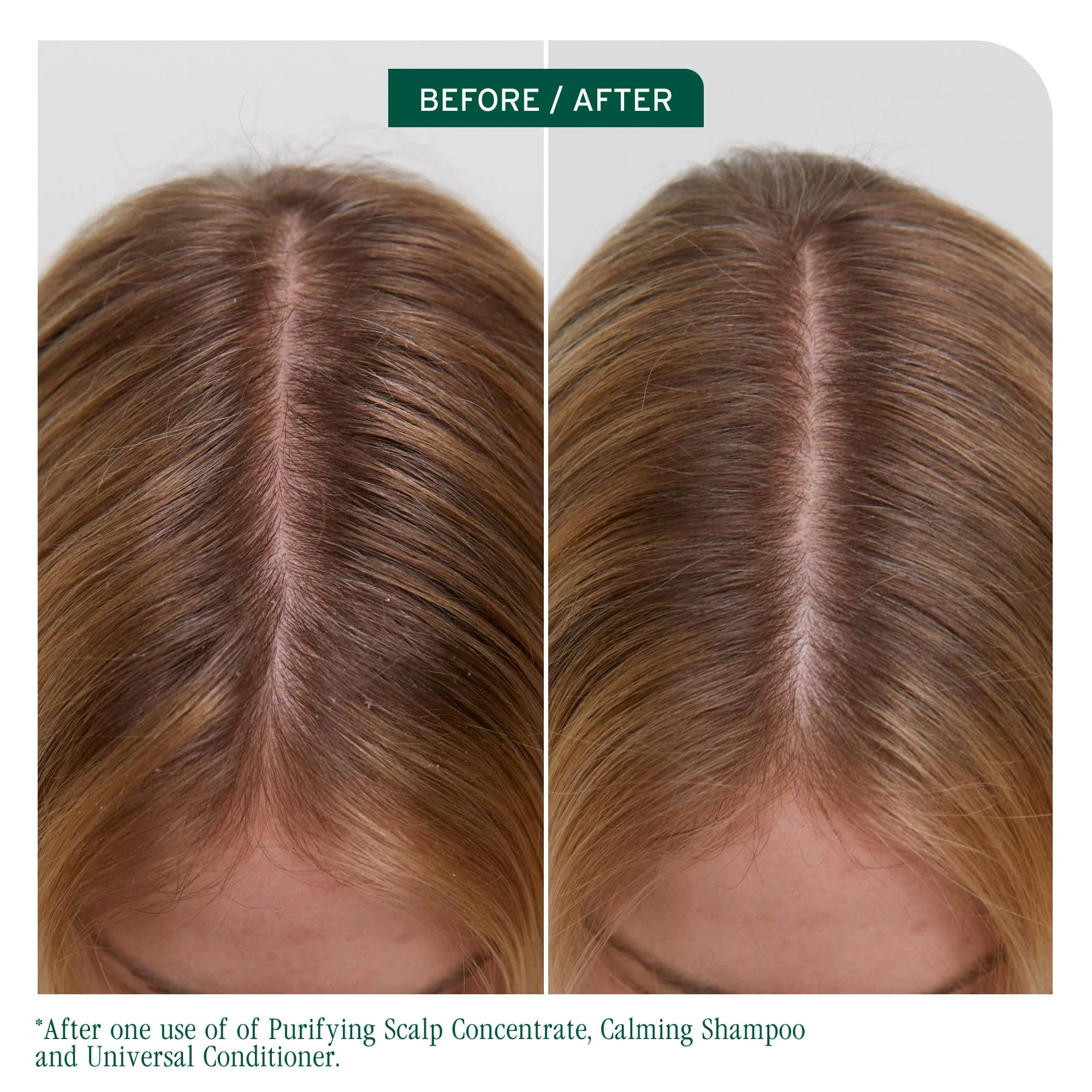 Biolage Scalp Sync Universal Conditioner - Nourishing & Hydrating for All Scalp Types, Lightweight Moisturizing & Conditioning, Fermented Tea Blend & Glycolic Acid, Vegan & Paraben-Free, 33.8 Fl Oz - Image 2