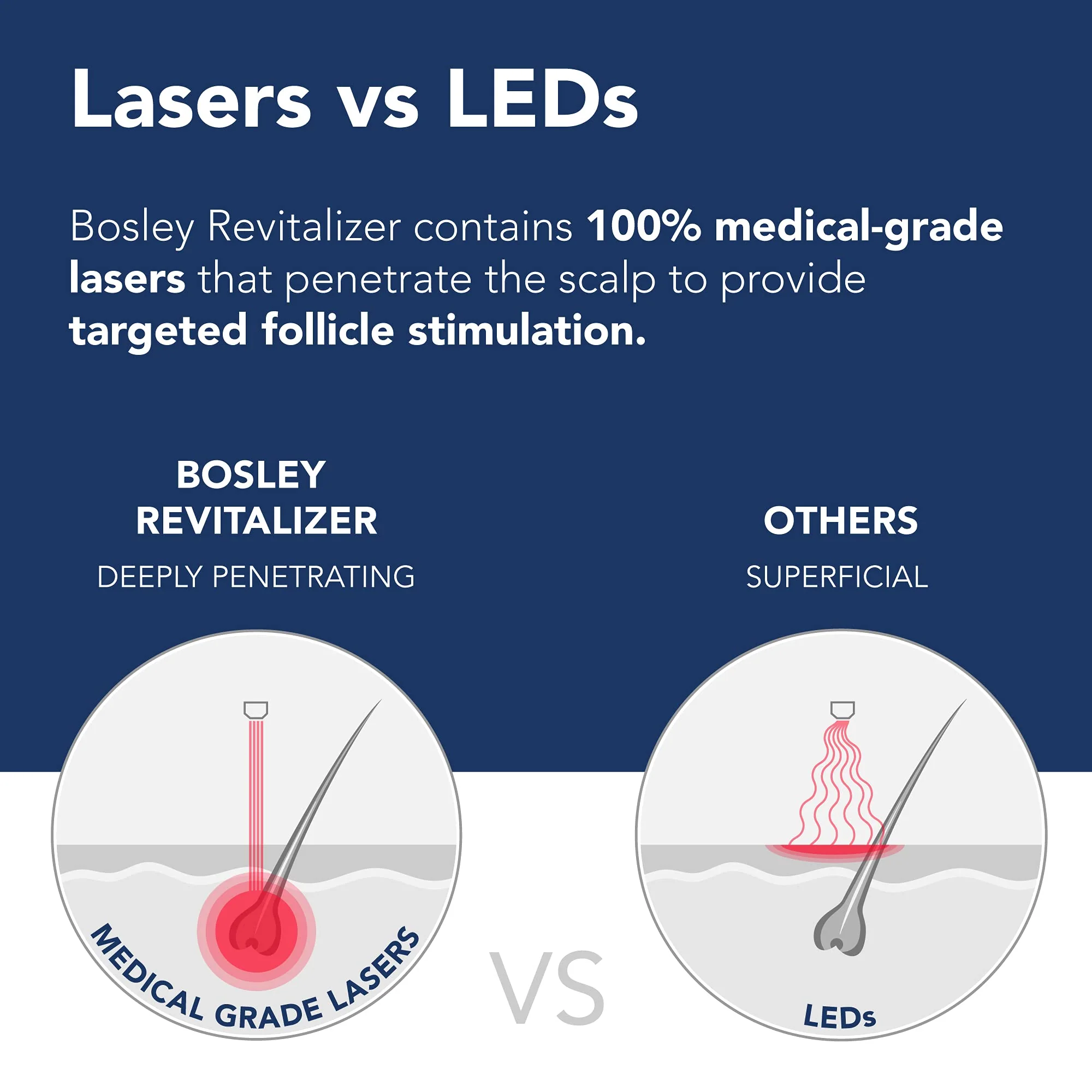 Bosley Revitalizer 272 Flex 100% Laser No LEDs Hair Growth Cap (LLLT) Men and Women - Regrowth, Home Treatment, Thicker, Fuller, Healthy Hair, FDA Cleared, Large Size - Image 4