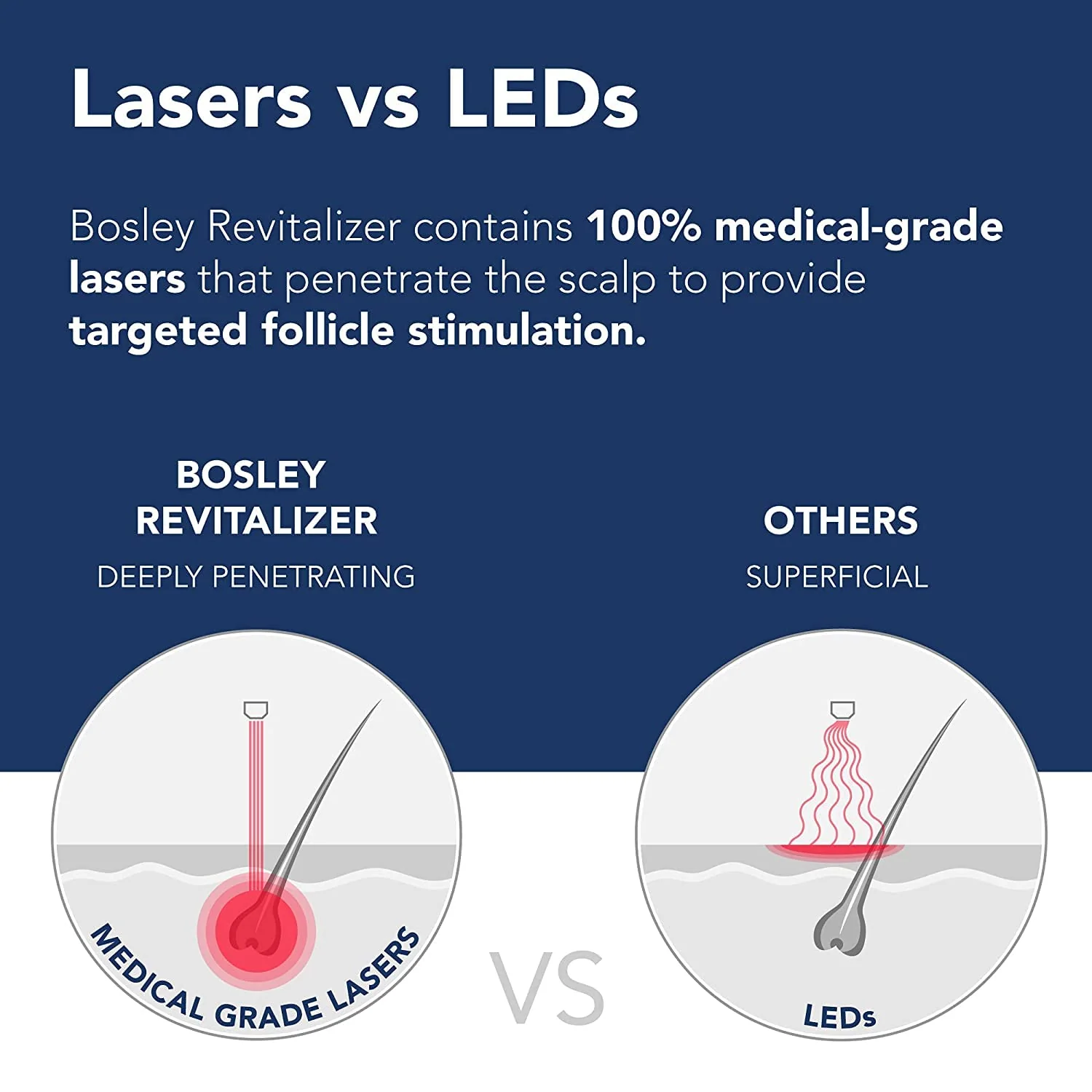 Bosley Revitalizer Flex 164 Diode 100% Laser No LEDs Hair Growth Cap (LLLT) Men and Women - Regrowth, Home Treatment, Thicker, Fuller, Healthy Hair, FDA Cleared. Large Size - Image 4