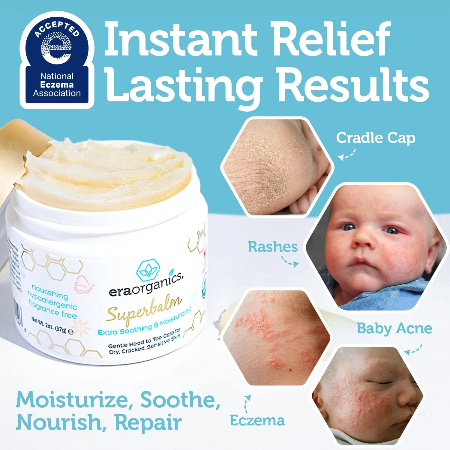 Era Organics Healing Ointment for Babies - USDA Certified Organic Natural Moisturizer Gentle on Sensitive Skin Prone To Baby Eczema, Cradle Cap (Infant Seborrheic Dermatitis), Rashes, Hives and More - Image 4