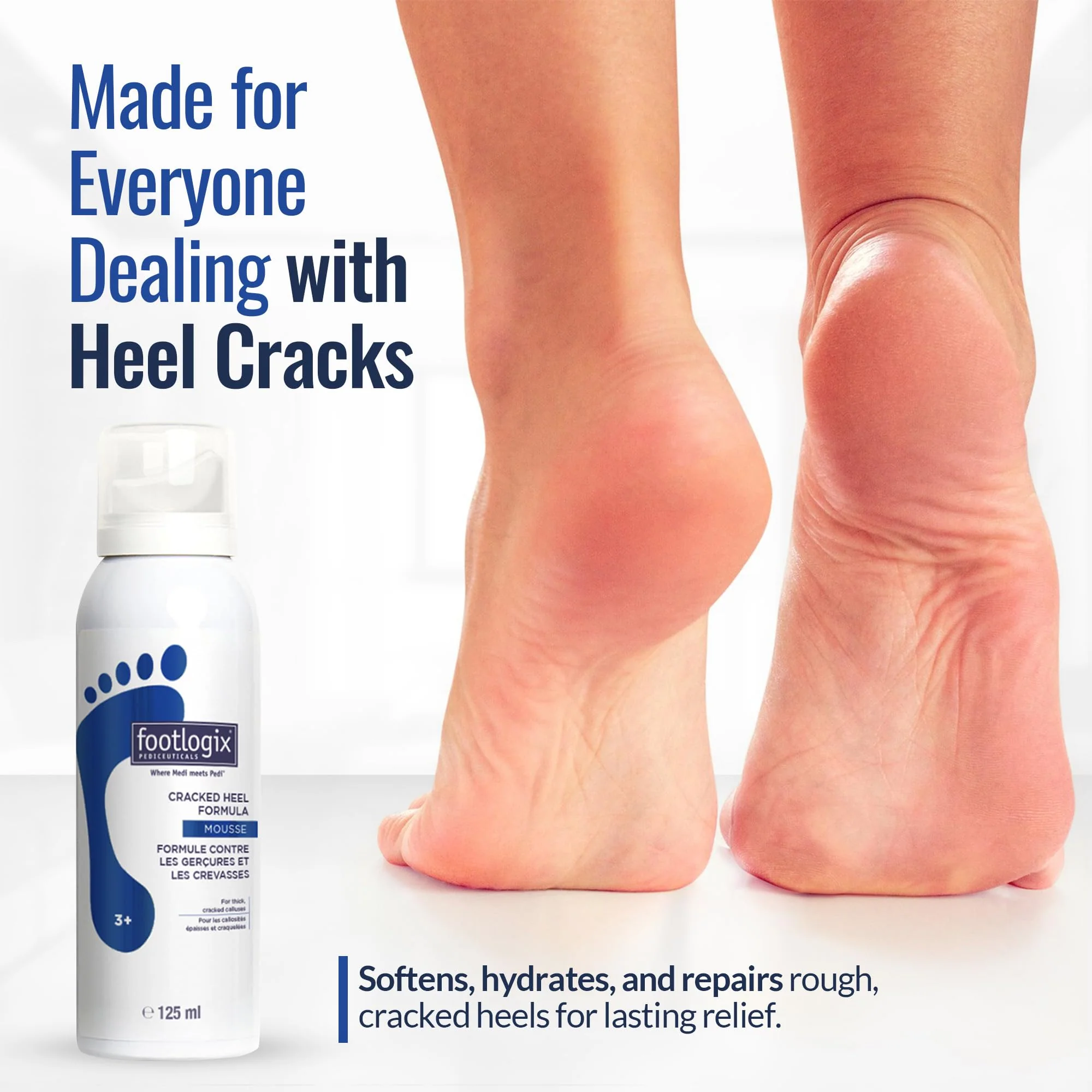 FOOTLOGIX Cracked Heel Formula, White 4.23 Ounce - Image 5