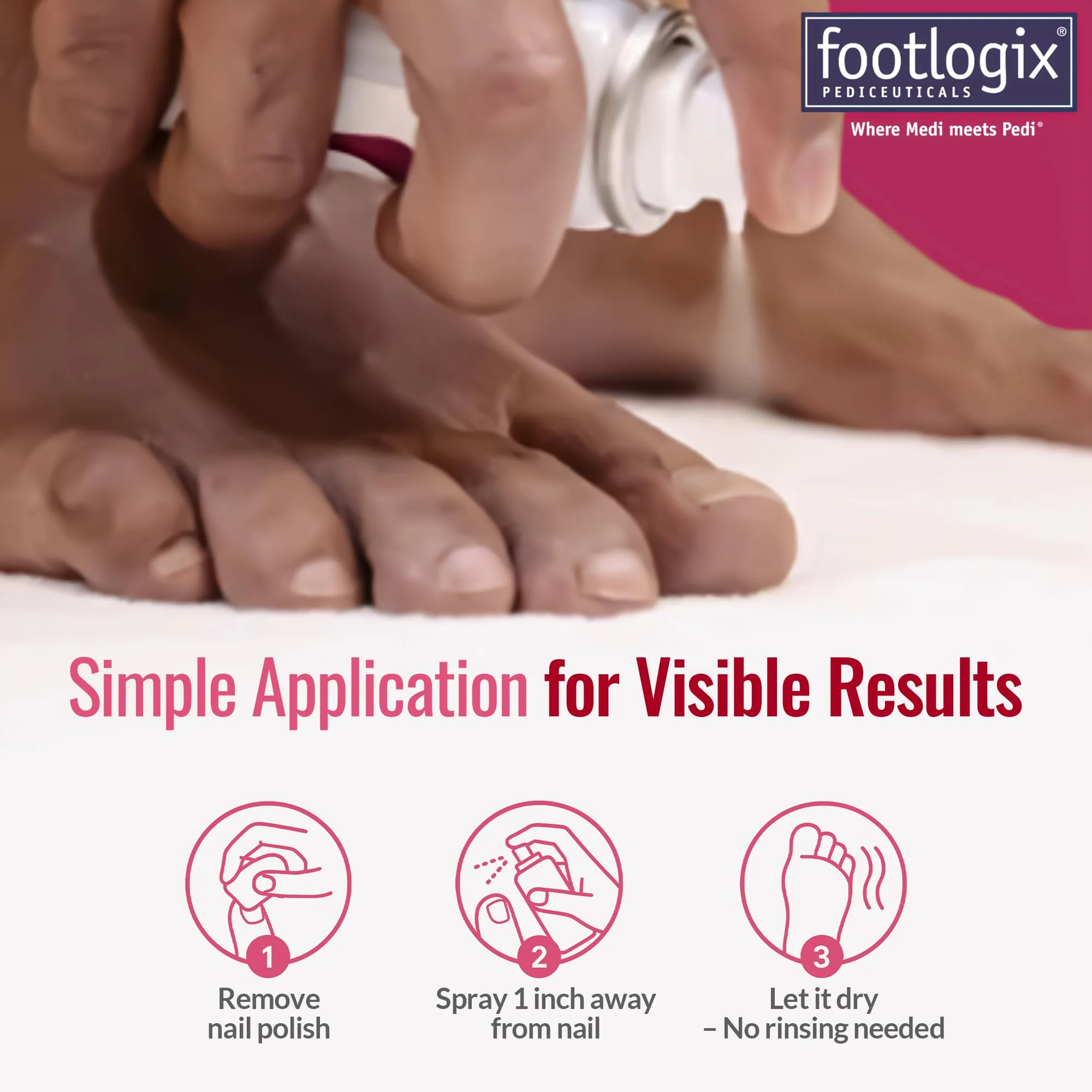 FOOTLOGIX Nail Tincture Spray with Spiraleen, 1.55 Fl Oz (Pack of 1) - Image 6