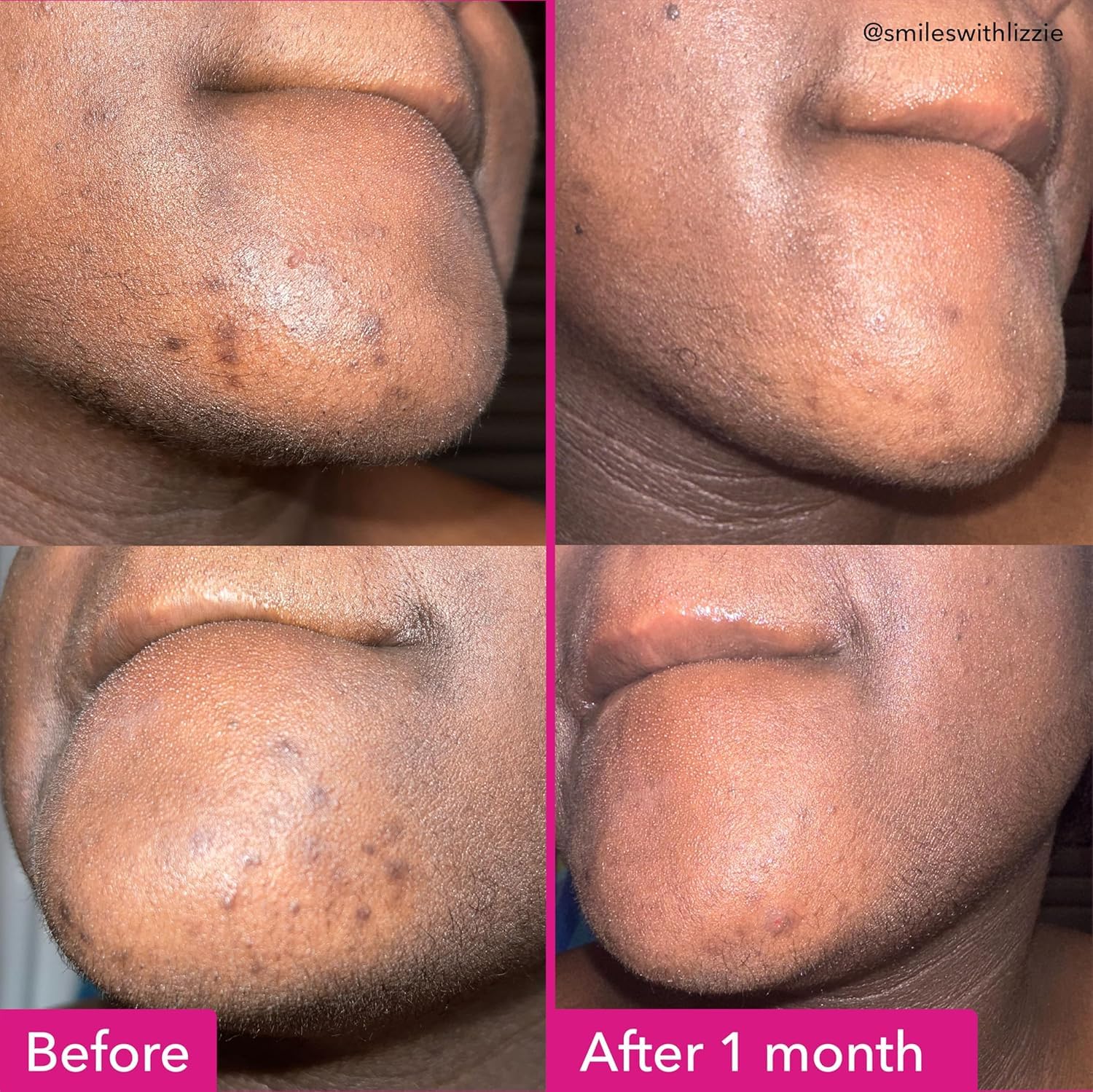 Good Molecules Brightening & Dark Spots Bar - Soap Free Face and Body Bar - Tranexamic, Kojic Acids and Niacinamide to Target Dark Spots - Skin Care - Image 3