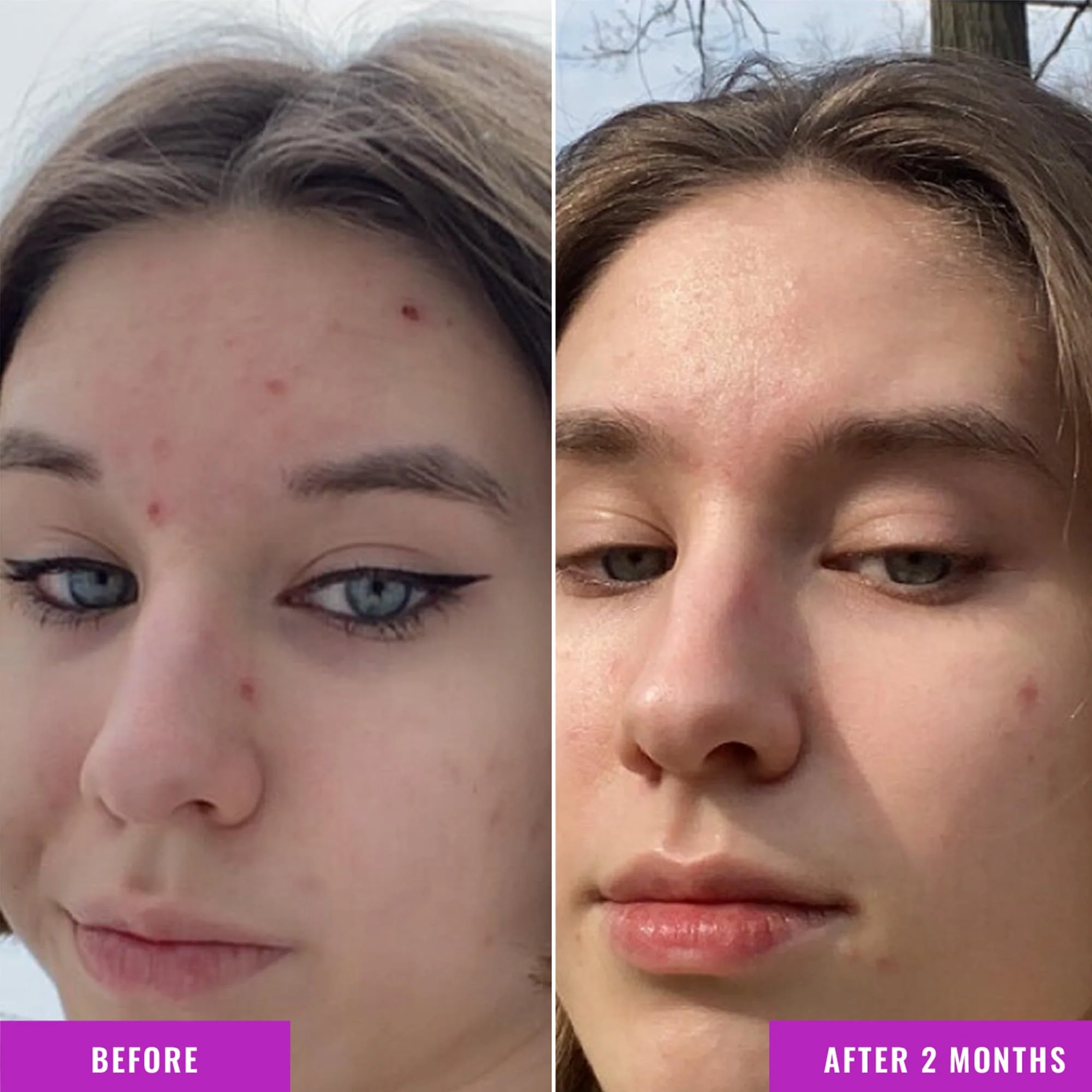 Good Molecules Niacinamide Serum - 10% Niacinamide to Target Blemishes, Nourishment, and Skin Tone - Ultra Hydrating Serum and Brightening Skin Care for Face - Image 4