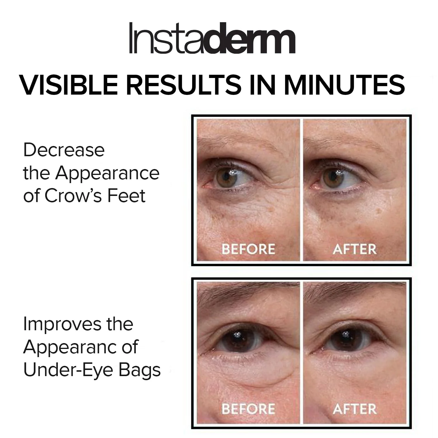Instant Eye Tightener – Instantly Reduces Under Eye Bags, Puffiness, Dark Circles, Wrinkles & Crow's Feet. Naturally Ageless Hydrating Cream. Disappears Before Your Eyes Within Minutes. - Image 4