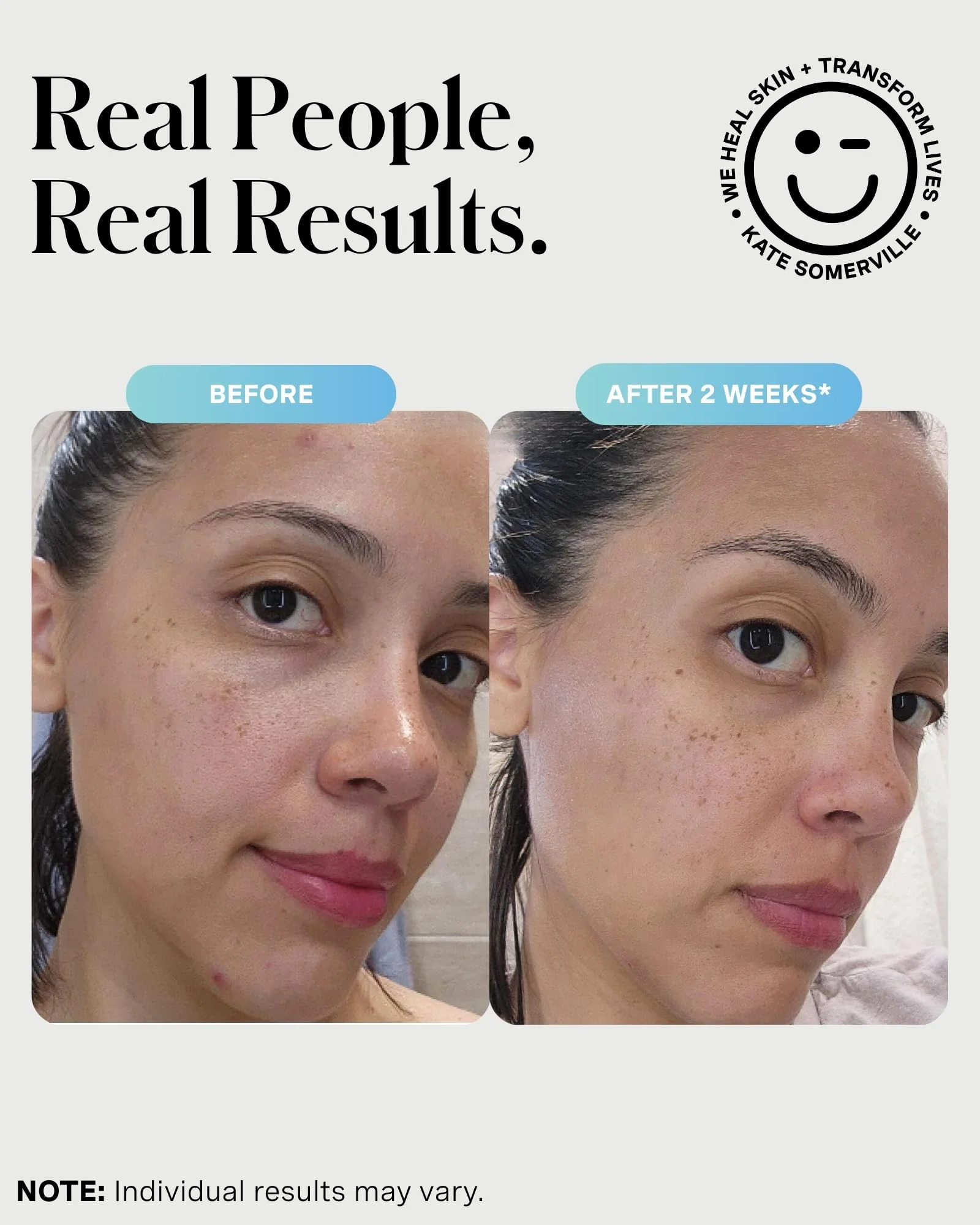 Kate Somerville EradiKate 3% Sulfur Daily Foaming Cleanser Acne Treatment – Clinically Formulated Medicated Face Wash Balances Skin & Cleans Pores, 4 Fl Oz - Image 5