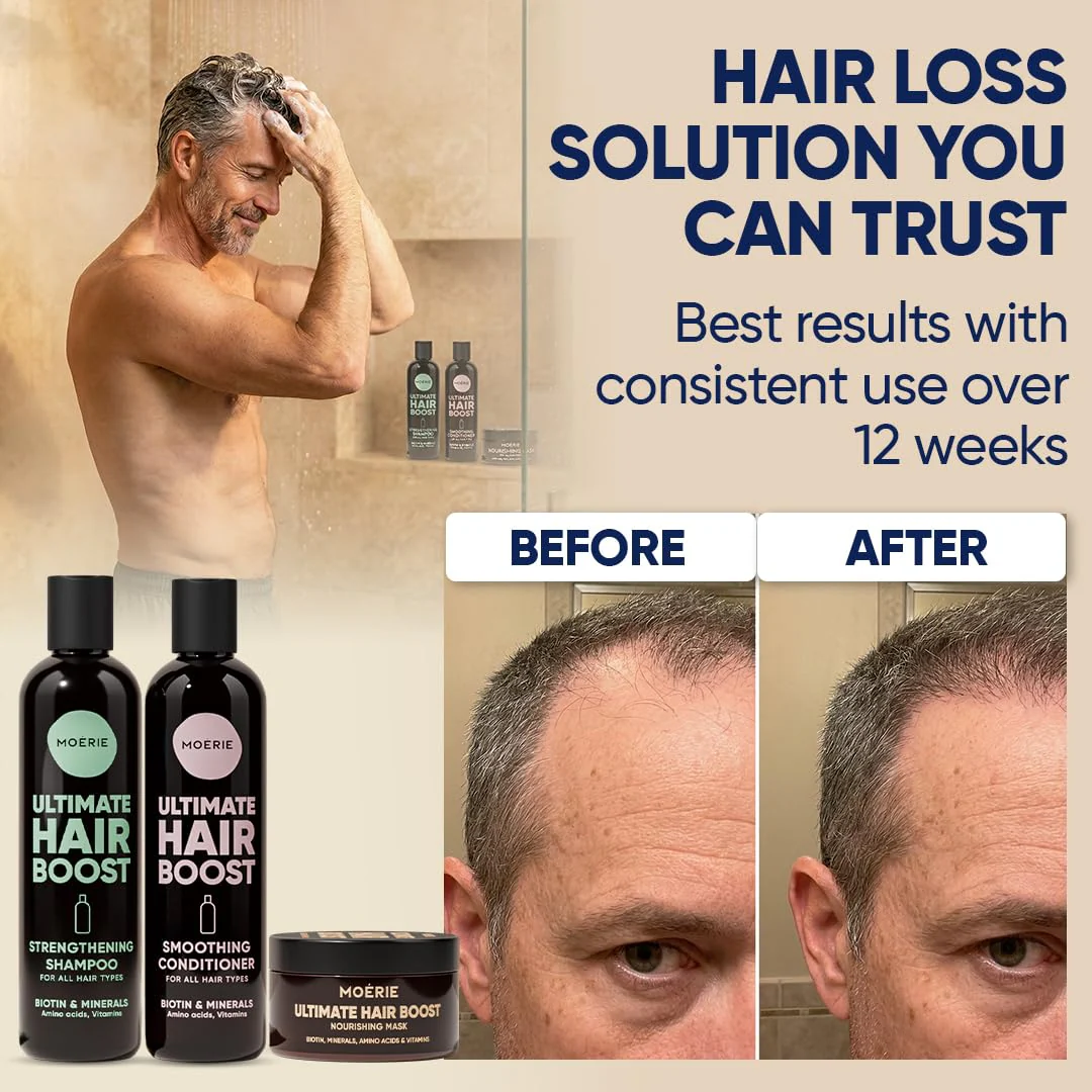 Moérie Hair Growth Shampoo, Conditioner and Mask - Hair Loss Solution with Biotin and Rosemary, Thickening Hair Regrowth Set for Thinning Hair - Ultimate Hair Growth Care (Double Set) - Image 4