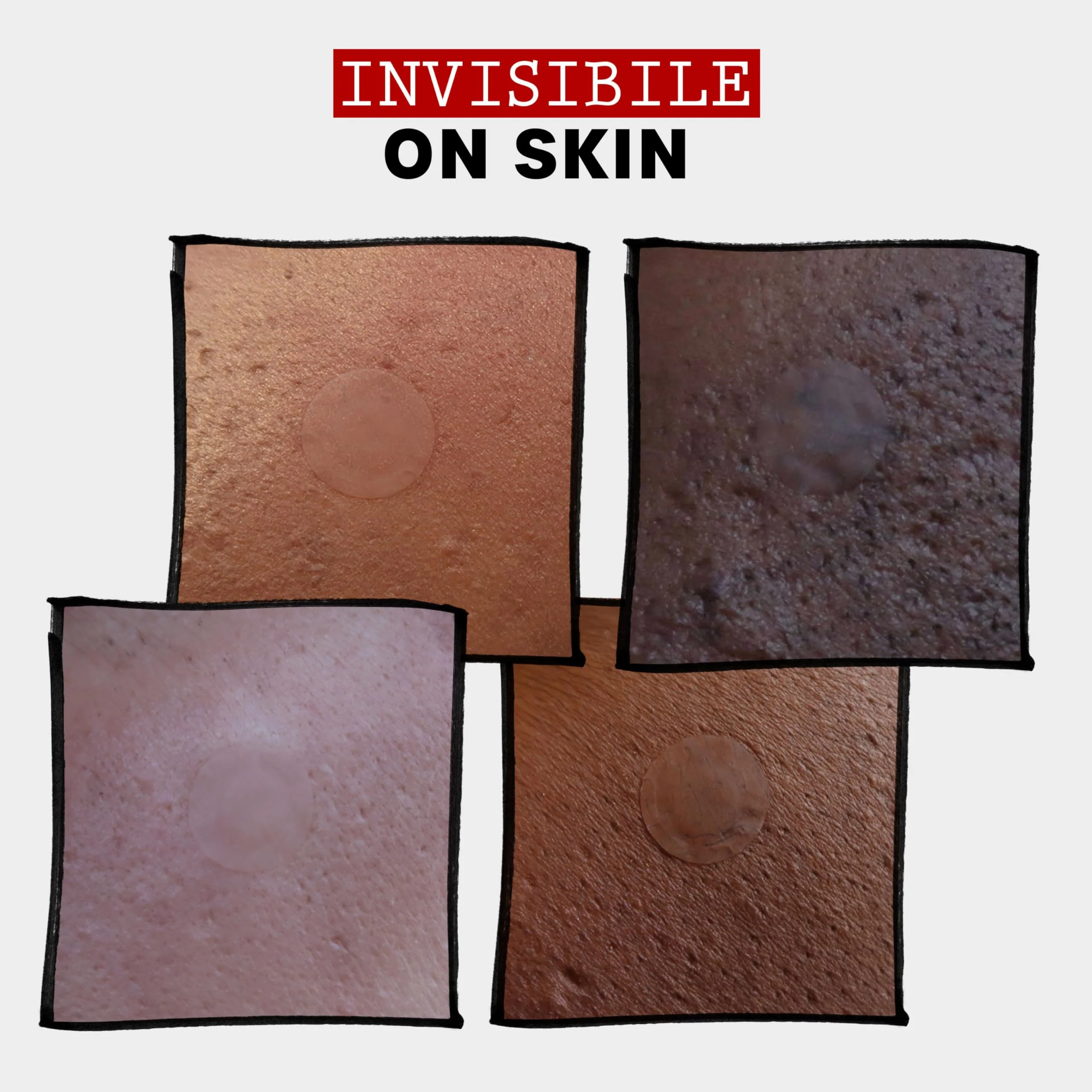 THAYERS Invisible S.O.S Hydrocolloid Acne Pimple Patch, Ultra-Thin Design Instantly Reduces Look of Blemishes, Set of 22 Pimple Patches - Image 5