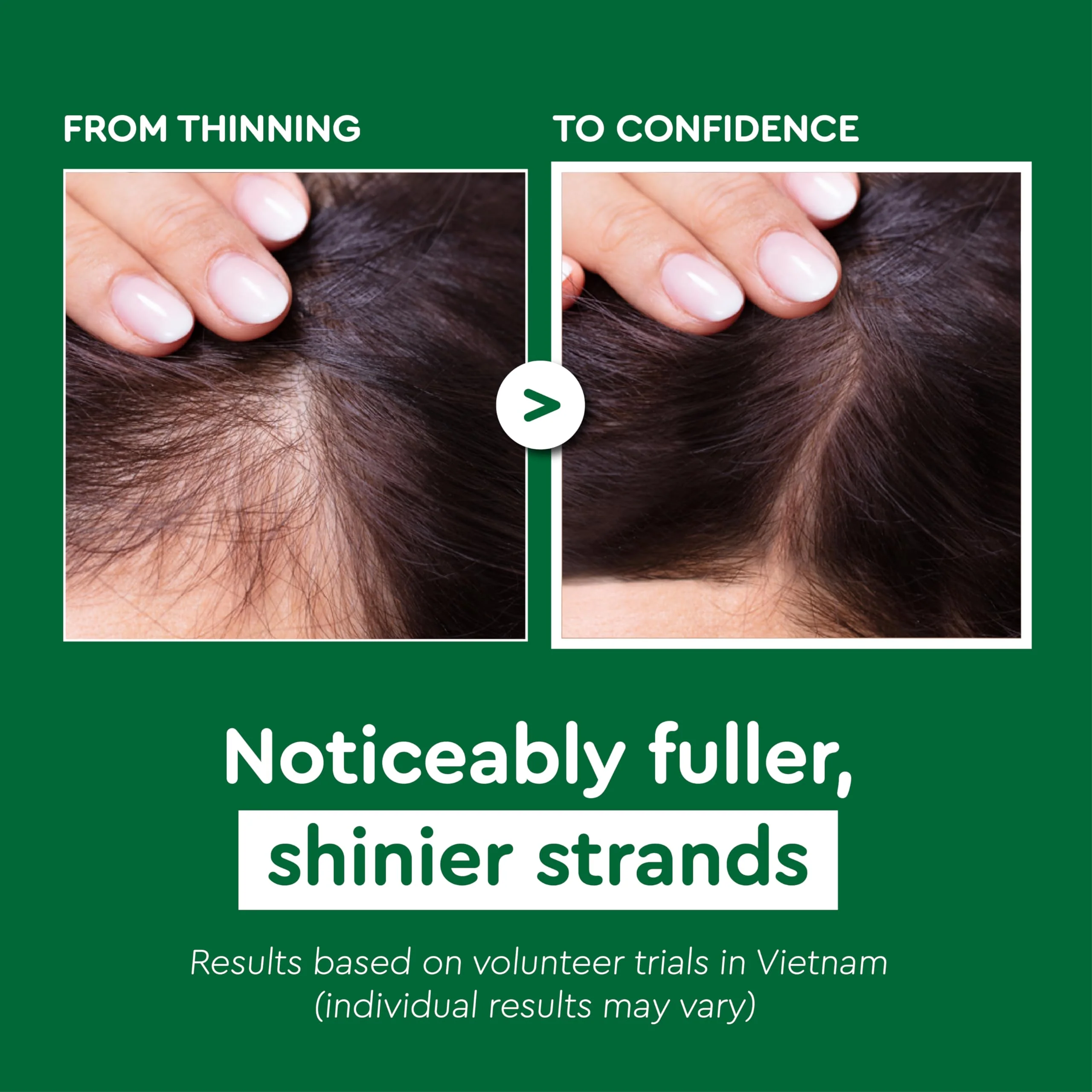 VIETNAM Hair Growth Shampoo for Thinning Hair with Polygonum Multiflorum, 2 in 1 Shampoo & Conditioner, Strengthens Weak Roots, Fuller Thicker Look, Mothers Day Gifts for Mom (14.8 oz) - Image 8